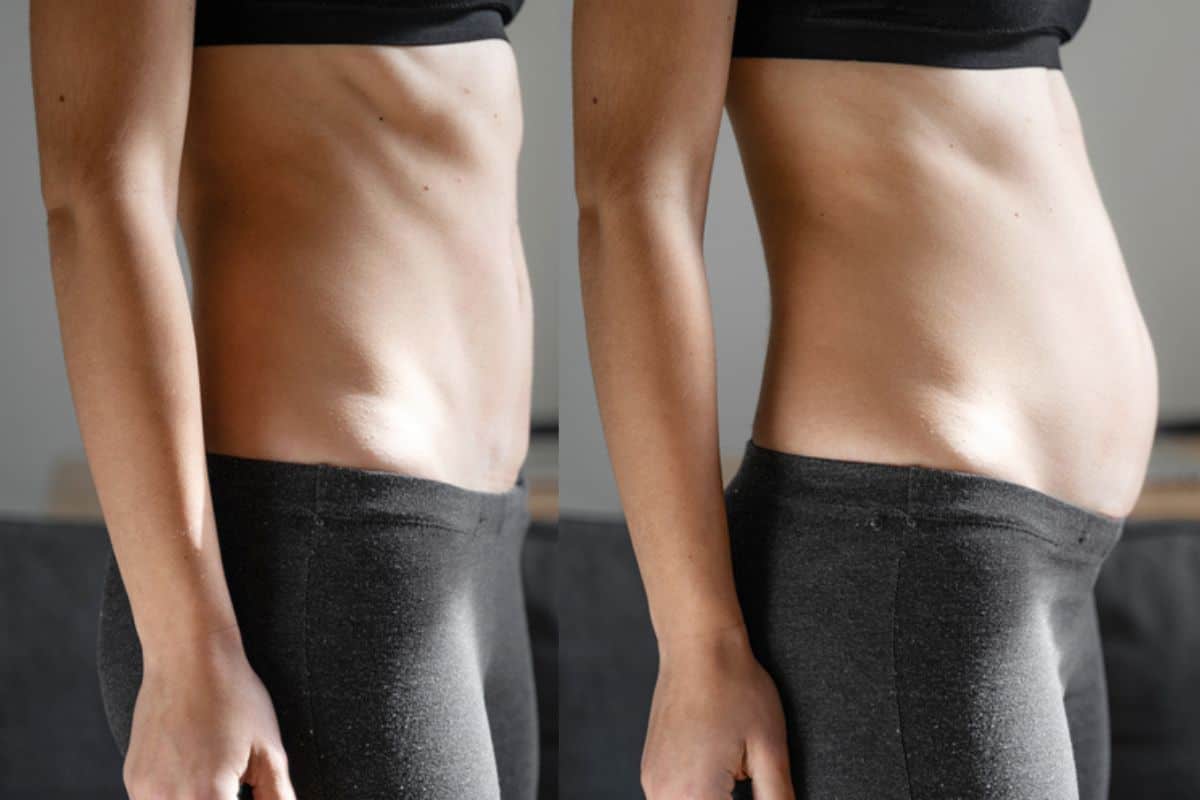 How long does diastasis recti take to improve Basingstoke?