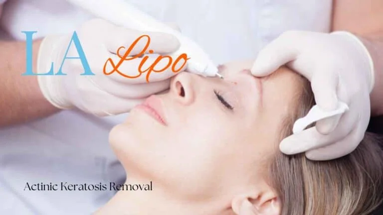 Woman receiving Actinic Keratosis Removal Treatment Basingstoke