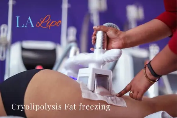women getting fat freezing Basingstoke