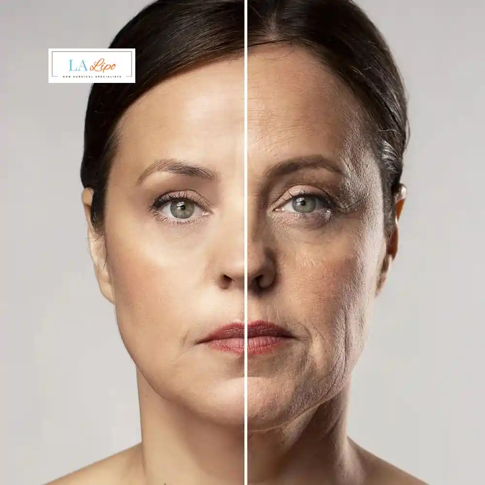 How Can You Tell If Non-Surgical Skin Tightening Is Right for You Basingstoke?