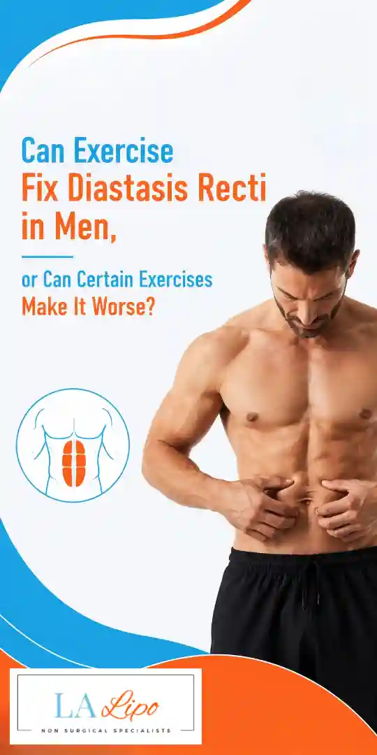 Can Exercise Fix Diastasis Recti in Men, or Can Certain Exercises Make It Worse Basingstoke?